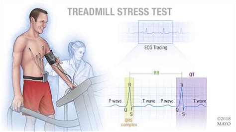 diastolic blood pressure drops during stress test|blood pressure drop during stress test.